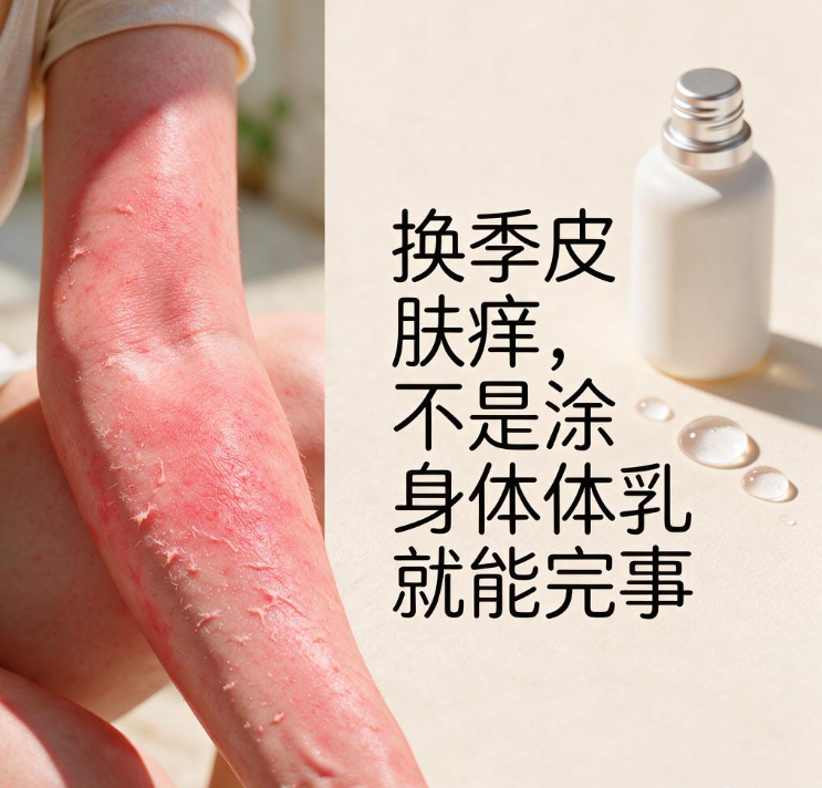 换季皮肤痒，不是涂身体乳就能完事